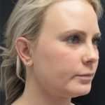 before female embrace rf left angle