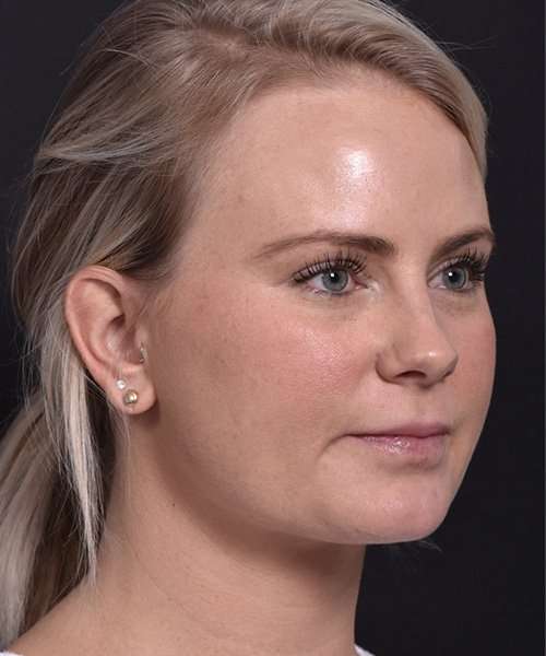 after female embrace rf left angle
