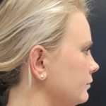 before female embrace rf right side