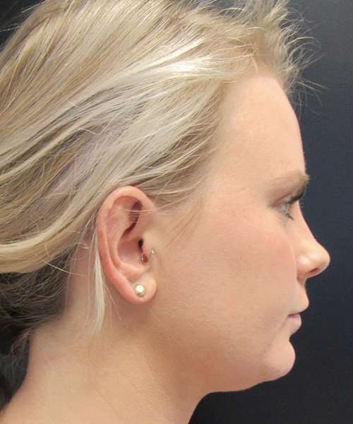 before female embrace rf right side