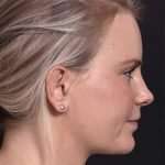 after female embrace rf right side
