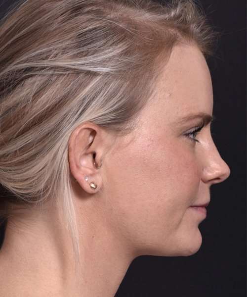 after female embrace rf right side