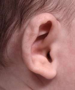 before newborn ear correction