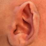 before newborn ear correction right