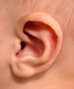 7-week-old boy newborn non-surgical ear correction after
