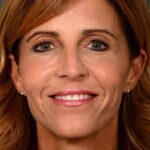 after female non-surgical liquid facelift front