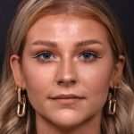 Chin filler contouring