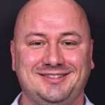 Lipoma forehead bump soft