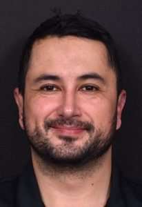 Otoplasty ear surgery after