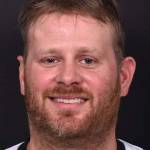 Forehead lump bump lipoma soft know surgery treatment