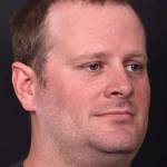 Forehead lipoma bump knot soft treatment