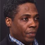 Aviva Atlanta lipoma forehead bump fat treatment scarless best