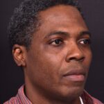 Aviva Atlanta lipoma forehead bump fat treatment scarless best