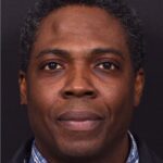 Aviva Atlanta lipoma forehead bump fat treatment scarless best