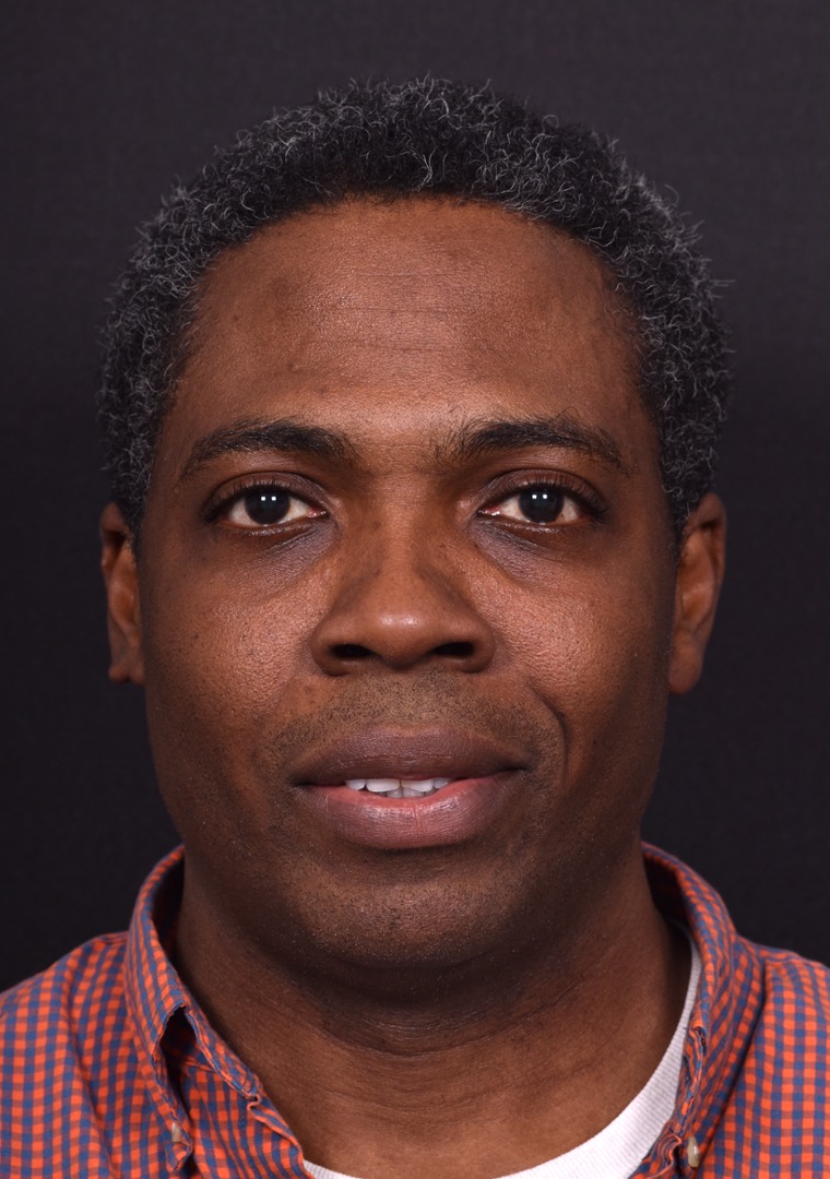 Aviva Atlanta lipoma forehead bump fat treatment scarless best