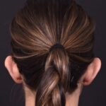 Otoplasty Atlanta ear surgery ear pinning best expert before after