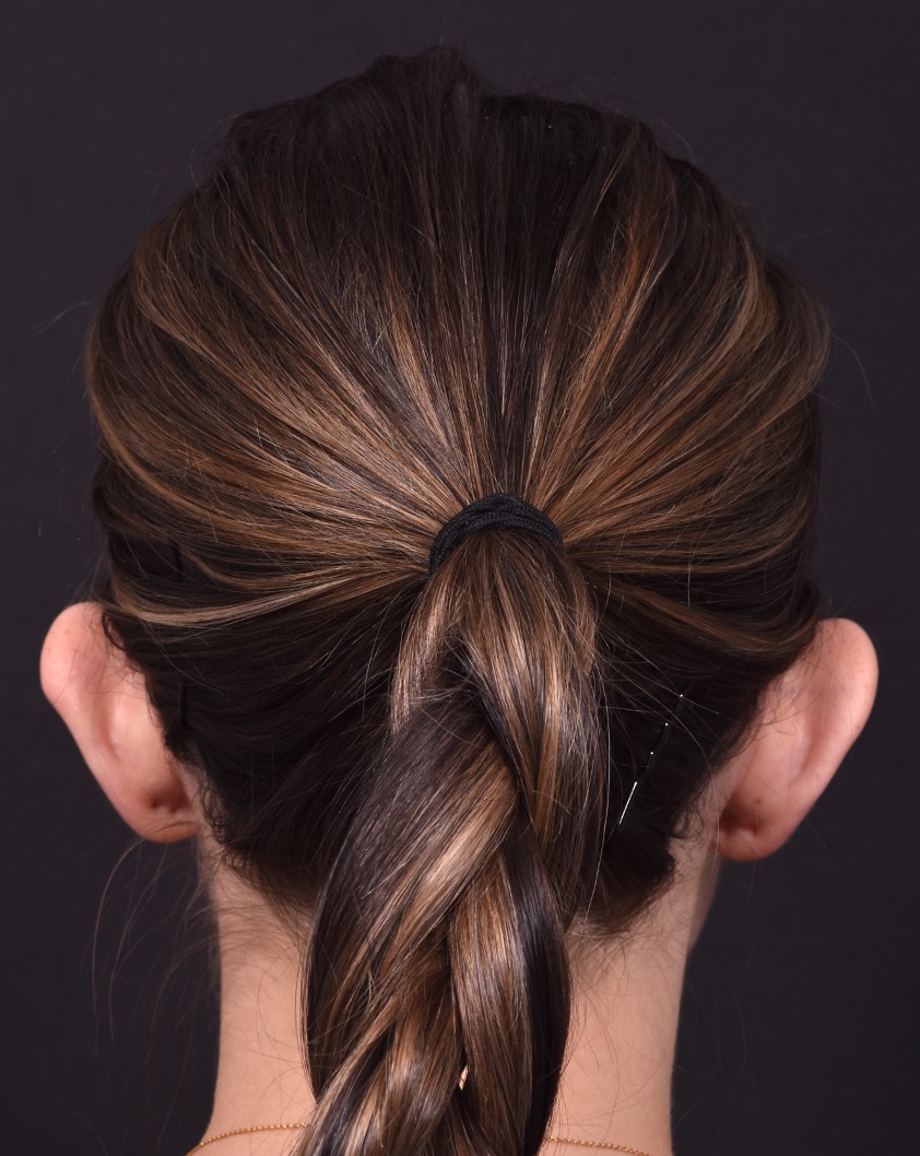 Otoplasty Atlanta ear surgery ear pinning best expert before after