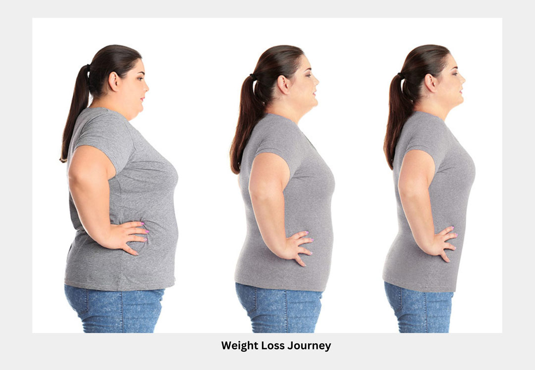 Weight Loss Journey