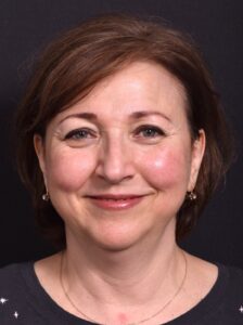 Atlanta blepharoplasty lid lift eyelid droopy best before after expert plastic surgery female woman surgeon deep plane facelift