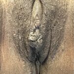 Aviva labiaplasty Atlanta near me clitoral hood reduction best before after results recovery expert cosmetic gynecology female