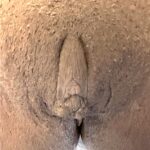 Atlanta labiaplasty Aviva best expert near me recovery results plastic surgery