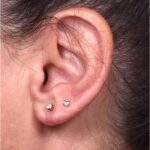 Earlobe reduction too long surgery plastic expert otoplasty best near me Atlanta female