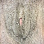 Labiaplasty near me best before after expert plastic surgery Atlanta woman surgeon clitoral hood reduction