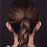 Otoplasty cost near me best expert female plastic surgeon results before after Atlanta ear surgery