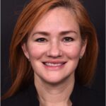 Atlanta deep plane face lift best expert near me female surgeon neck liplift