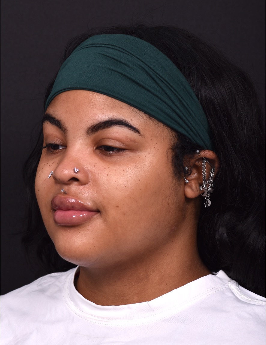 Deep plane neck lift isolated structural liposuction lipo before and after best expert near me collagen Atlanta