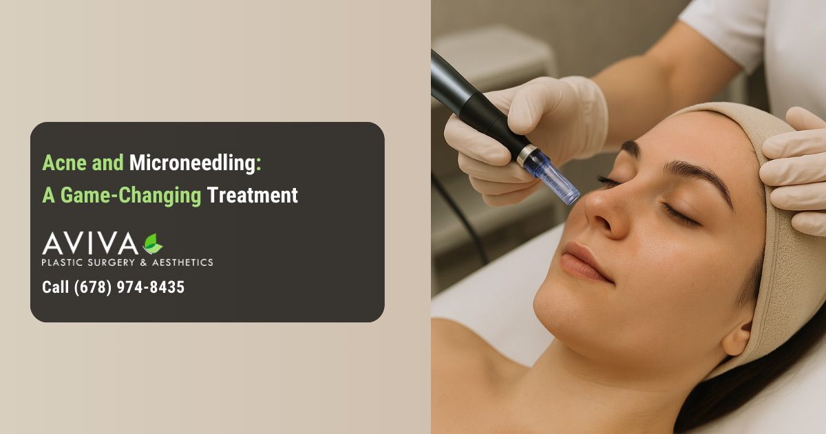 Acne and Microneedling: A Game-Changing Treatment