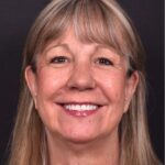 Before and after rhinoplasty results showing improved nasal shape and facial balance by Dr. Inessa Fishman at Aviva Plastic Surgery in Atlanta. Rhinoplasty nose job before and afer best expert near me collagen surgery plastic surgeon expert