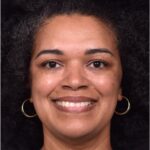 Atlanta lipoma osteoma bump forehead scarless collagen surgery results best plastic surgeon near me endoscopic laparoscopic