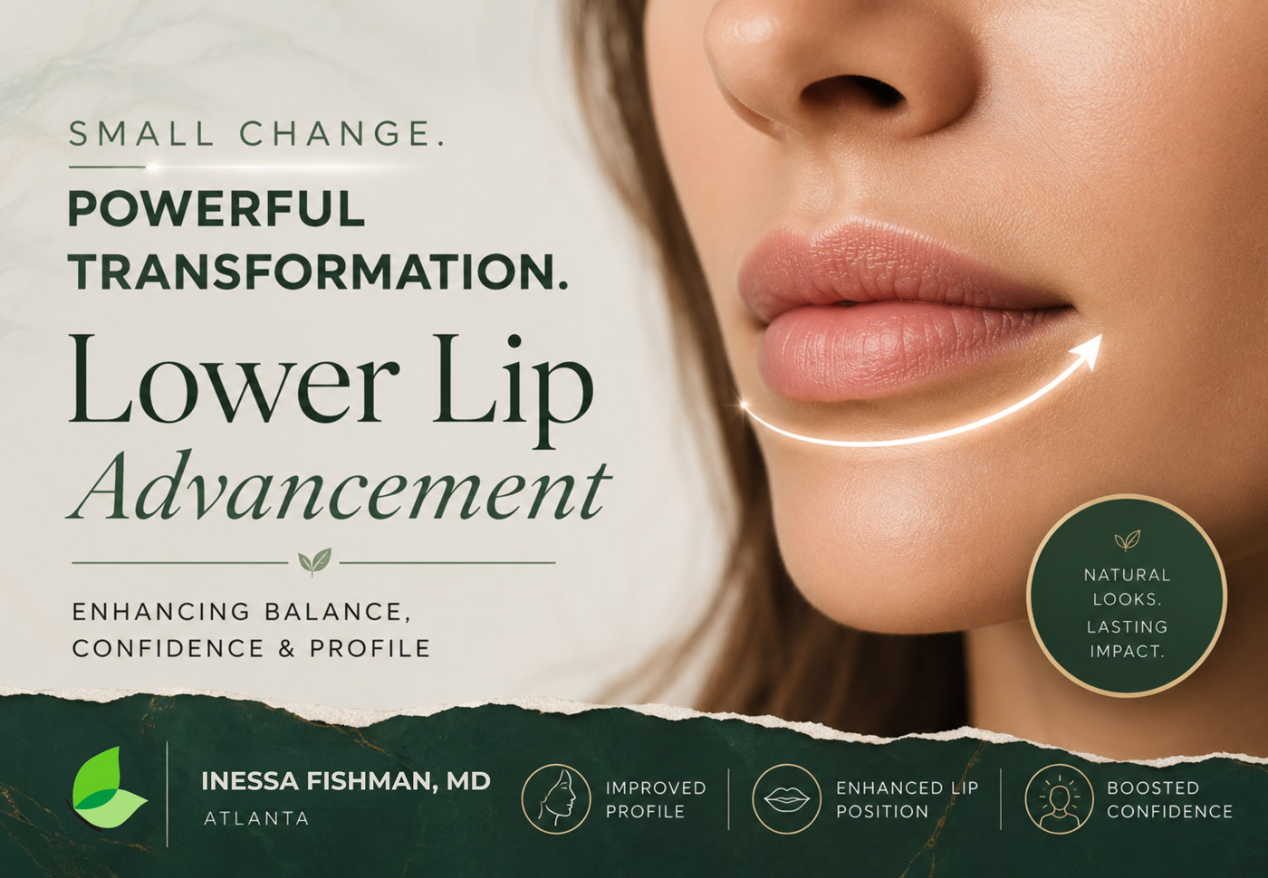 Lower lip advancement small change powerful transformation - Inessa Fishman MD Atlanta
