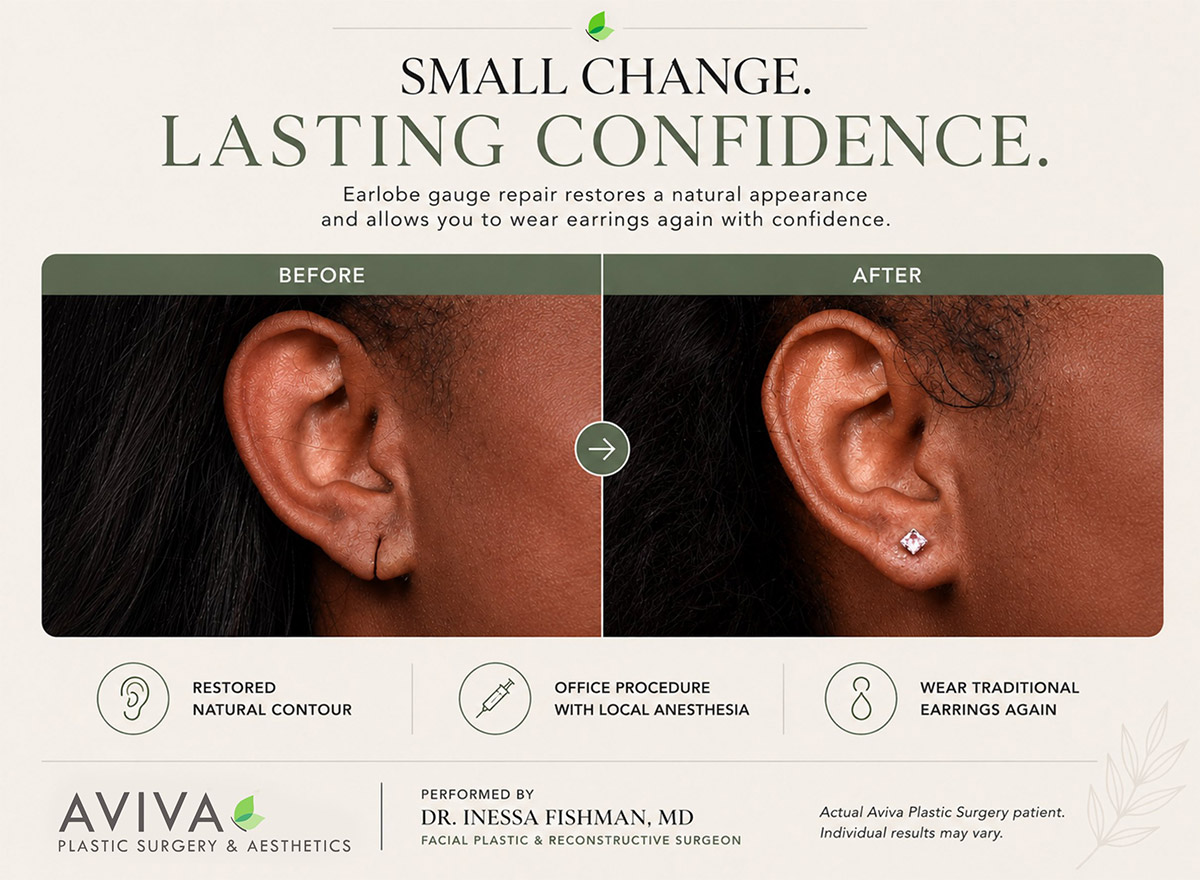 Before and after torn earlobe repair with re-piercing by Dr. Inessa Fishman
