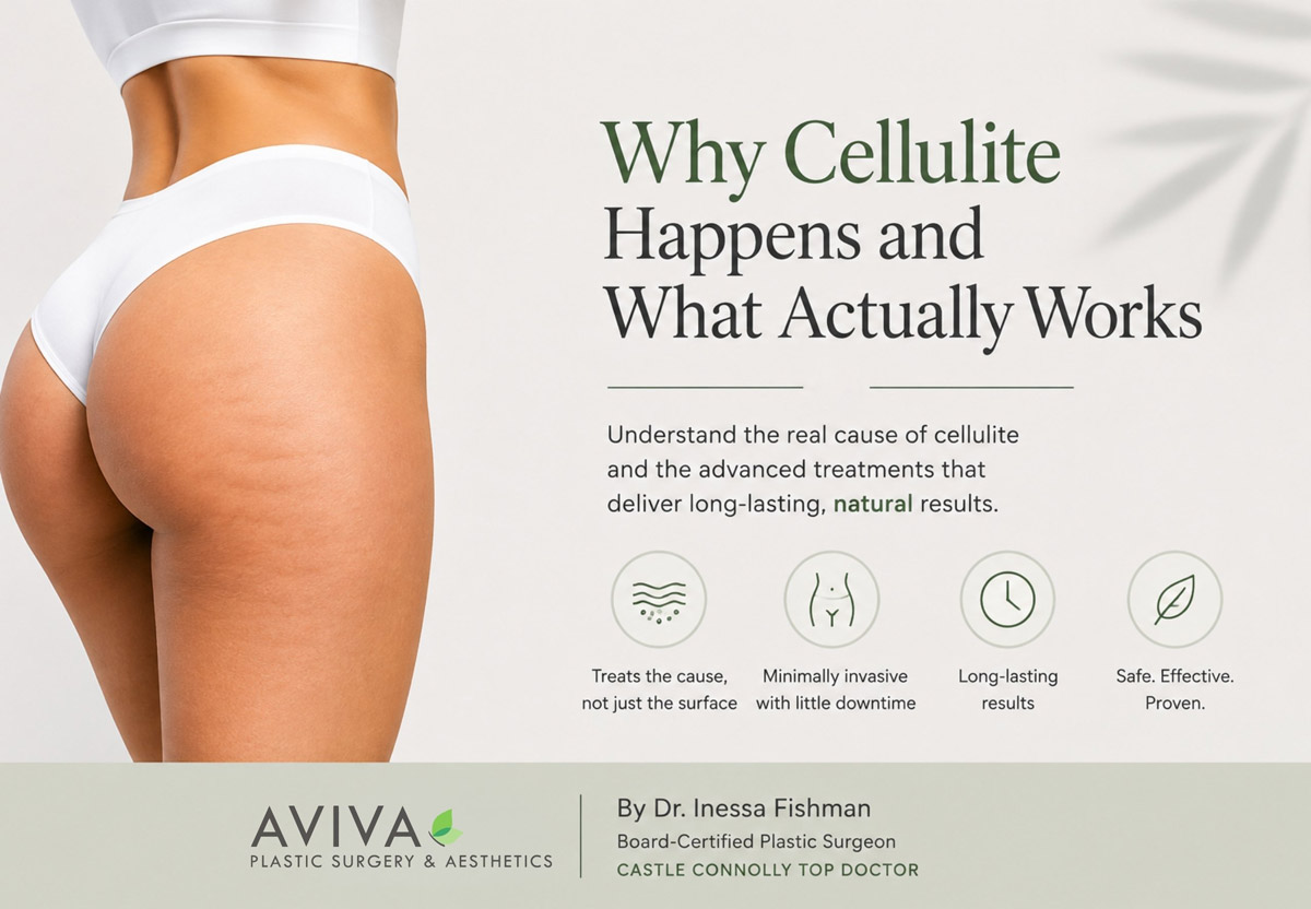 Cellulite treatment educational graphic for Aviva Plastic Surgery and Aesthetics in Atlanta