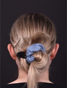 Atlanta otoplasty ear surgery best expert near me collagen art scarless female surgeon