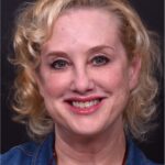 Lip lift best expert near me Atlanta collagen results before and after scarless permanent