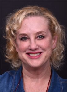 Lip lift best expert near me Atlanta collagen results before and after scarless permanent